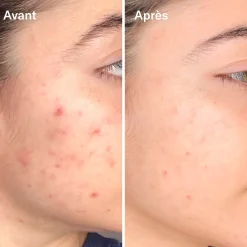 Sérums*Odacité Bl+C Serum Concentré Anti-Imperfections Cumin Noir + Cajeput