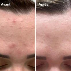 Sérums*Odacité Bl+C Serum Concentré Anti-Imperfections Cumin Noir + Cajeput