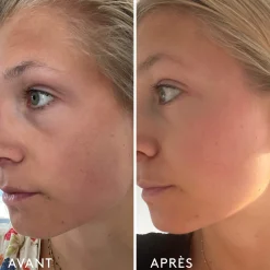 Compléments Alimentaires|Peau*Oh My Cream Skincare Complément Alimentaire Repulpant