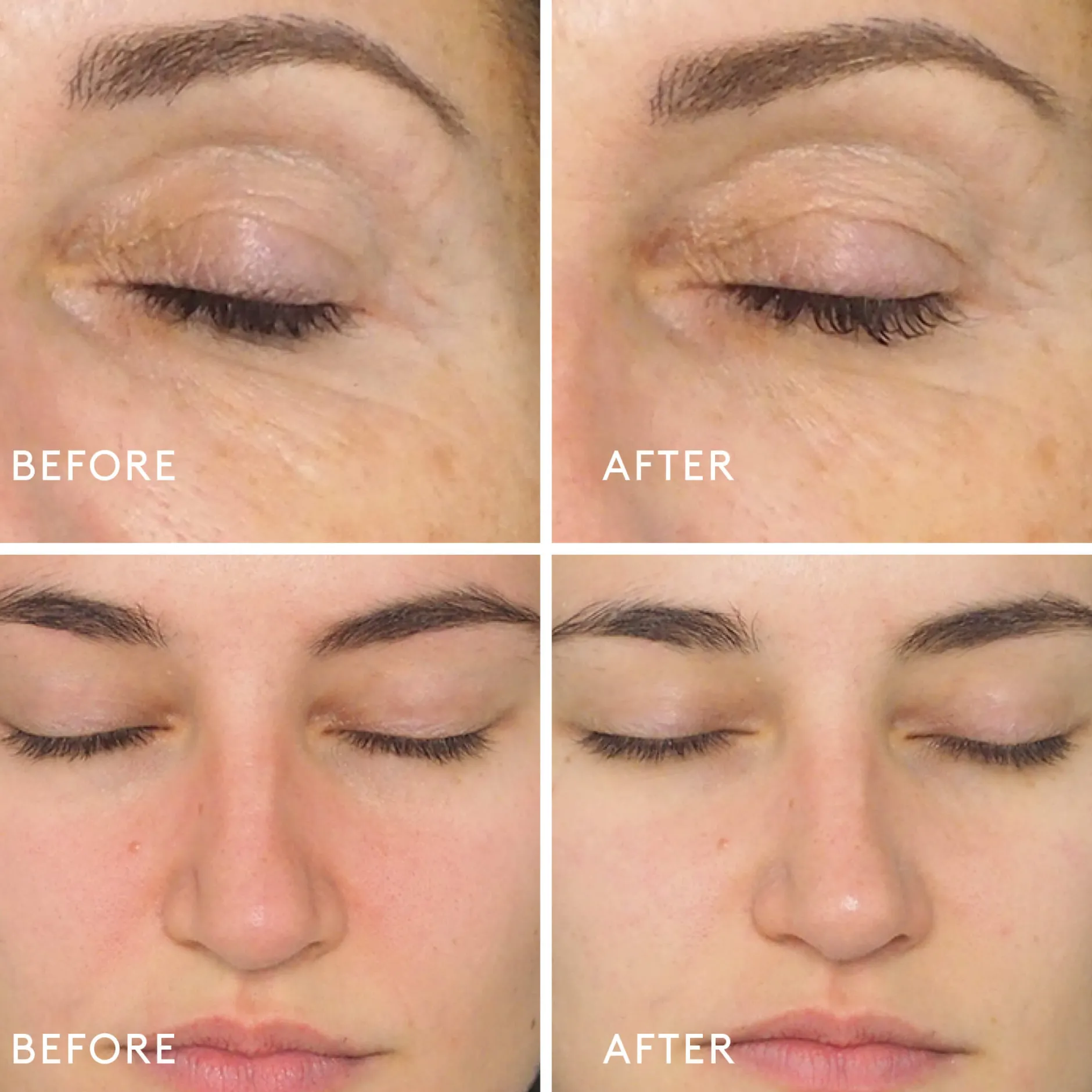 Exfoliants & Gommages*Dermalogica Daily Milkfoliant Poudre Exfoliante Douce