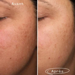 Sérums*Pai Skincare Fade Forward Sérum Anti-Taches