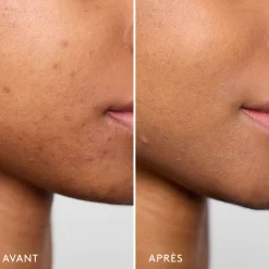 Bases De Teint|Soins Ciblés*Violette_FR Invisible Bandage Gel Apaisant & Réparateur