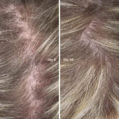 Compléments Alimentaires|Cheveux*Combeau L'Essentiel Cheveux