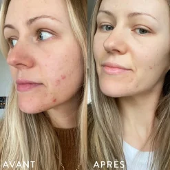 Peau|Digestion*Atelier Nubio Microbiote & Peau