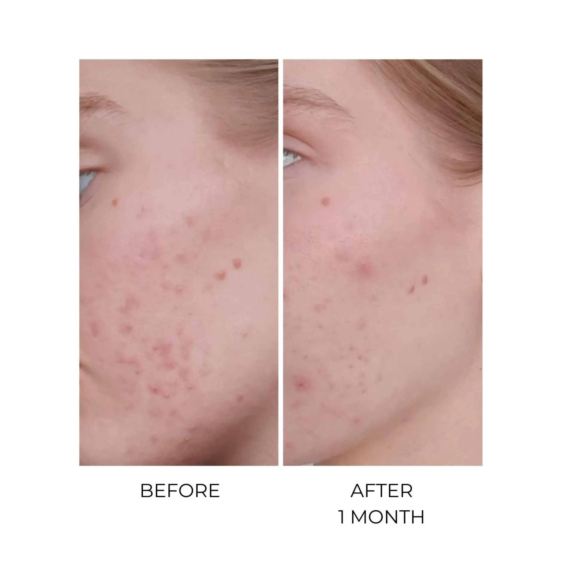 Compléments Alimentaires|Cheveux*Oskia MSM Bio-Plus